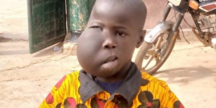 N’Zérékoré : l’appel déchirant d’une mère pour sauver son fils atteint d’une tumeur à la tête 1 N’Zérékoré : l’appel déchirant d’une mère pour sauver son fils atteint d’une tumeur à la tête