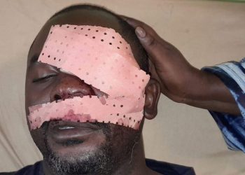 Violemment agressé par des jeunes en furie, le journaliste Daouda Bah perd un œil à Bomboli.