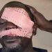 Violemment agressé par des jeunes en furie, le journaliste Daouda Bah perd un œil à Bomboli. 10 Violemment agressé par des jeunes en furie, le journaliste Daouda Bah perd un œil à Bomboli.
