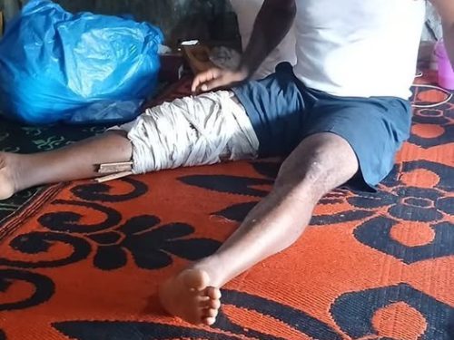 SOS pour un enseignant en détresse: Gnouma Robert Millimouno très malade, demande du soutien