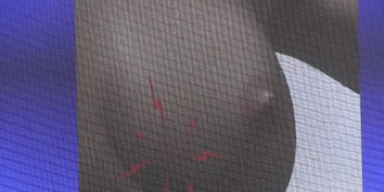 Octobre Rose : l'autopalpation, un geste pour prévenir le cancer du sein 1 Octobre Rose : l’autopalpation, un geste pour prévenir le cancer du sein